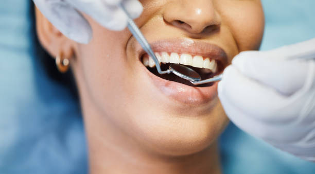 Best Emergency Broken Tooth Repair in Prescott, WI